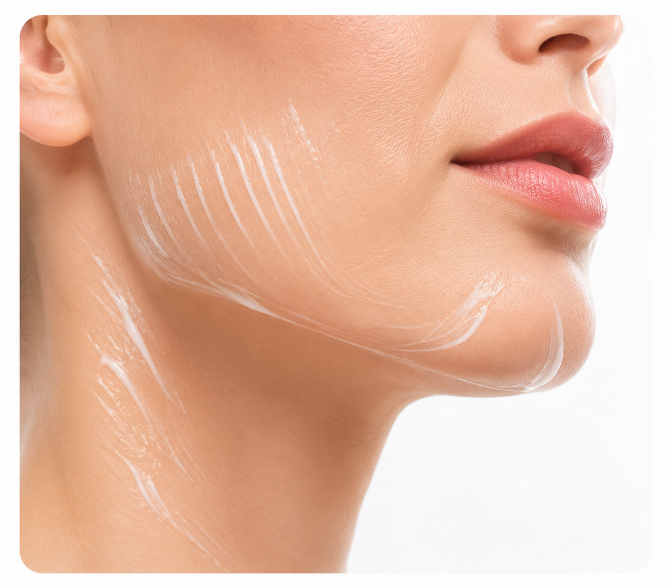Acne Scar Removal