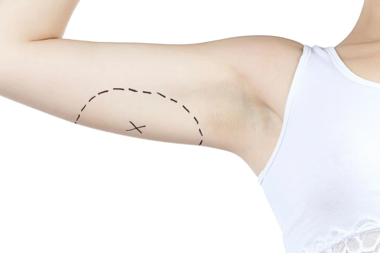 arms
