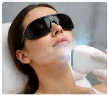 Acne Scar Removal