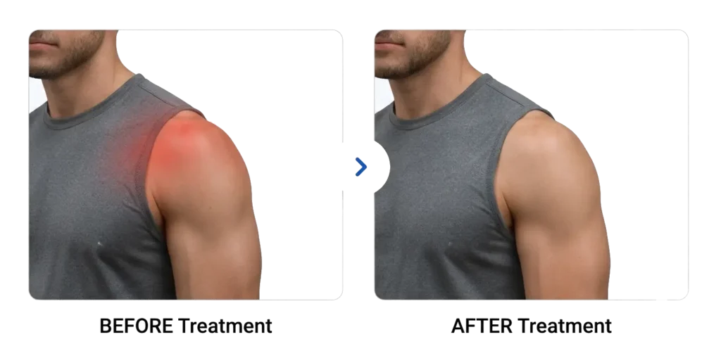 BEFORE & AFTER Real Results. Real Relief. focus